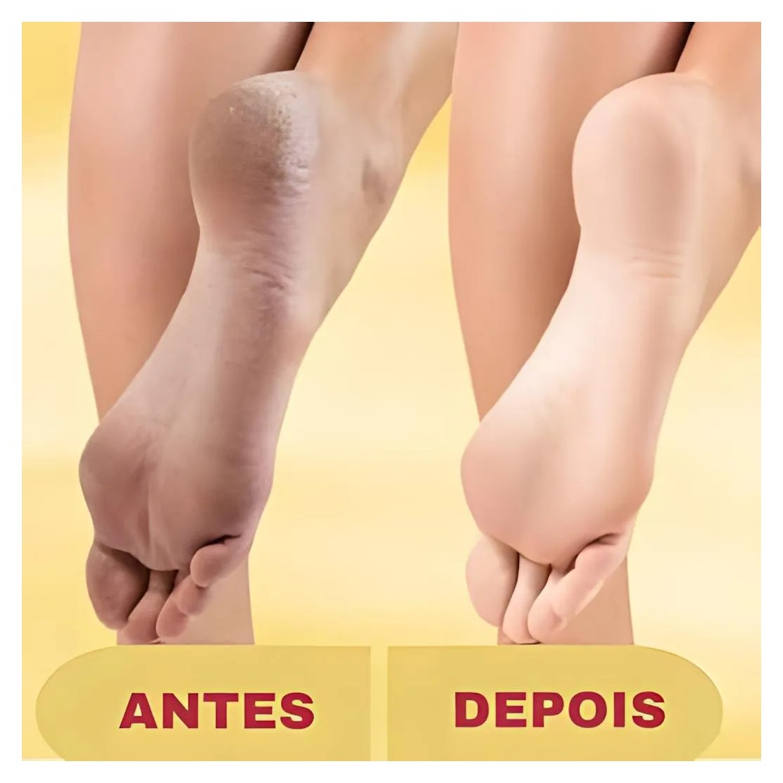 Lixa Elétrica Pés Pedicuro Removedor Calos E Rachaduras + Creme Esfoliante